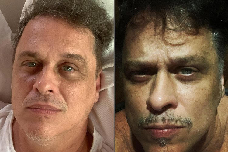 Ex-ator Global pede isenção e revisão das contas de luz