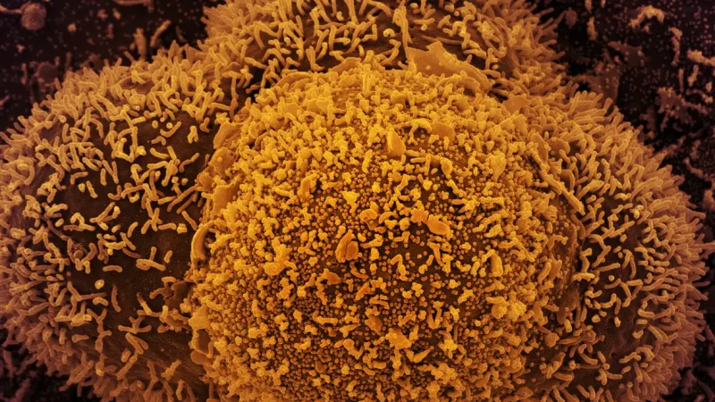 Covid-19: variante Ômicron XEC é identificada em três estados