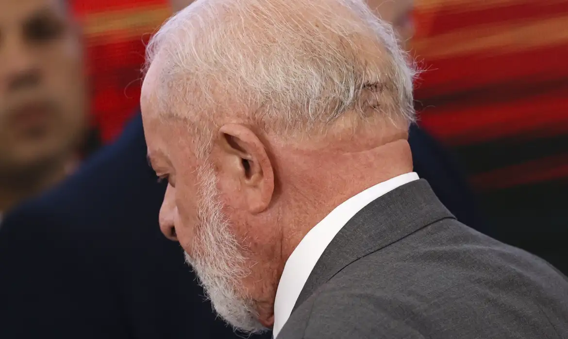 Lula passa por cirurgia após hemorragia intracraniana